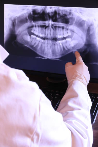 Best Emergency Root Canal Therapy in Jefferson, MD